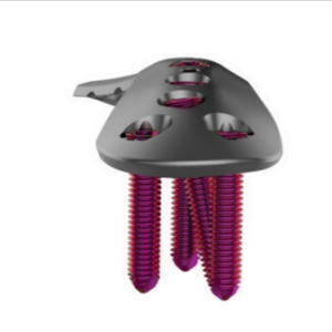 2.7/3.5mm Variable Angle Dorsolateral Distal Humerus Plate