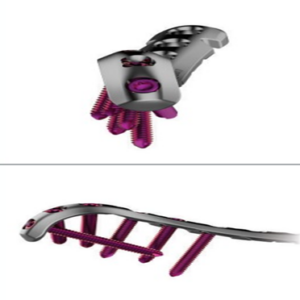 2.7/3.5mm Variable Angle Extended Medial Distal Humerus Plate